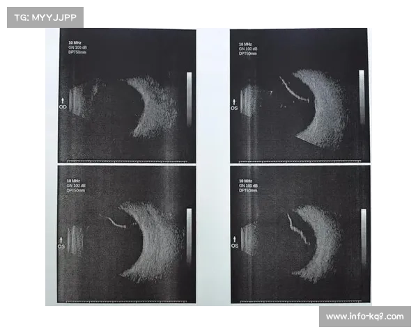 潘佩隆赛后接受医疗检查确认左眼视网膜轻微受损需进一步观察治疗